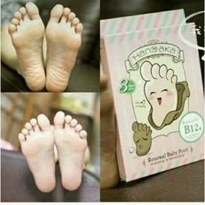 HANAKA BABY FOOT / HANAKA BABYFOOT / MASKER KAKI HANAKA